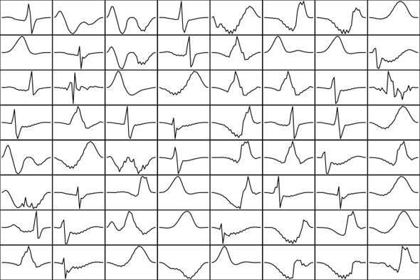 Dictionary of shapes from an EKG signal used as training data.